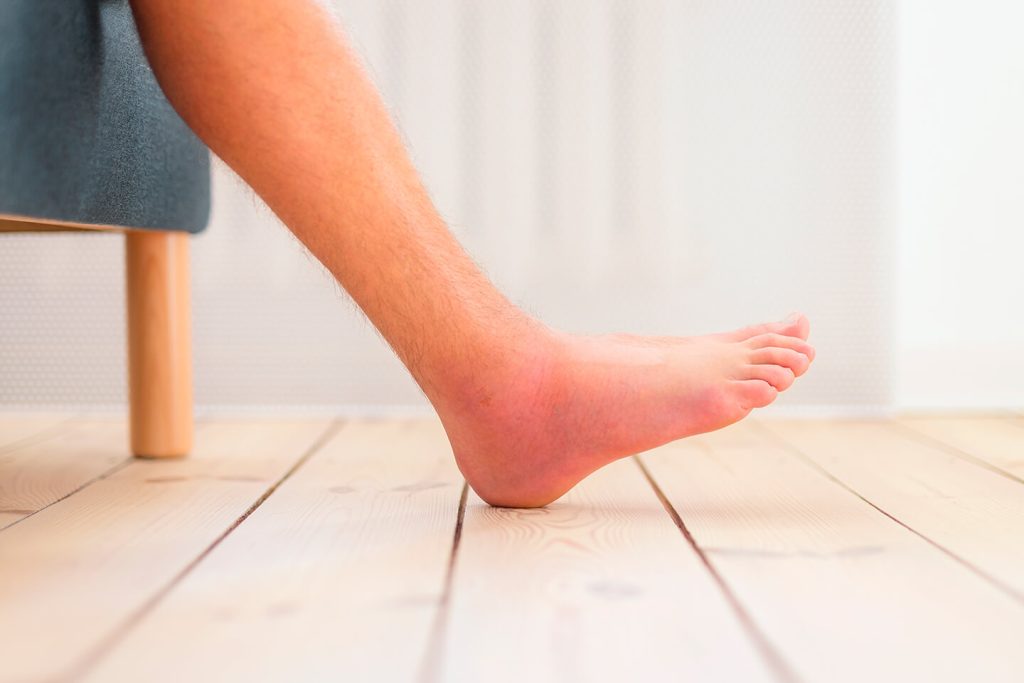 fisioterapia esguince