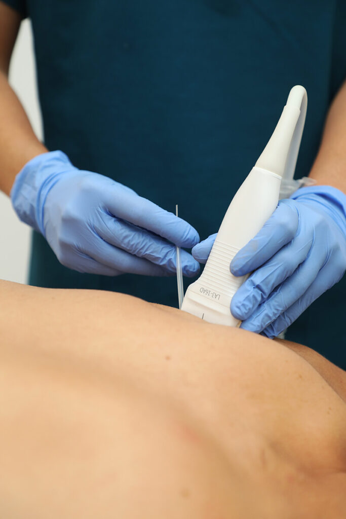 Fisioterapia invasiva Actium