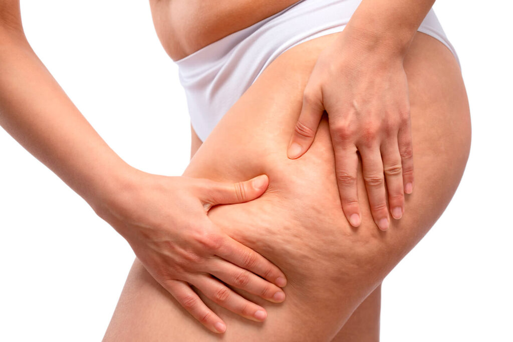 fisioterapia dermatofuncional0 piernas