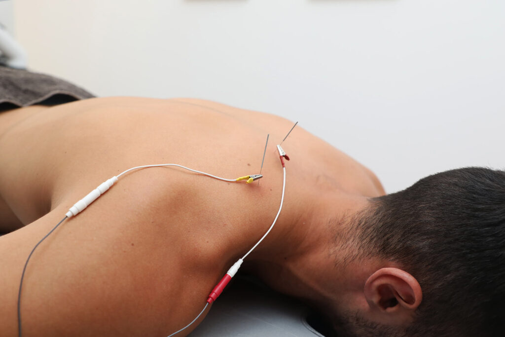 Clínica de Fisioterapia Invasiva en Alcalá de Henares